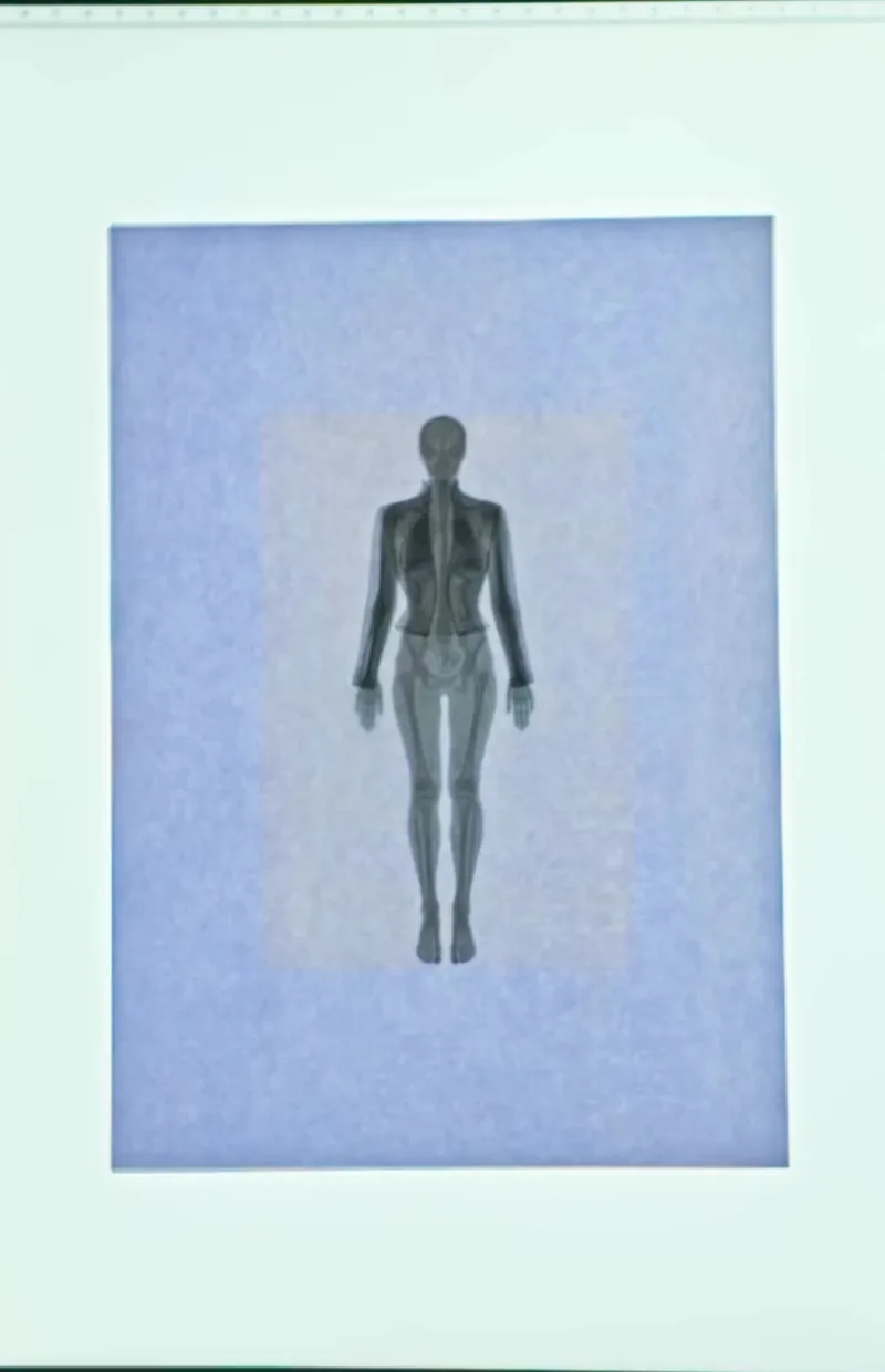La même planche, le corps vêtu d'une veste structurée en radiographie
